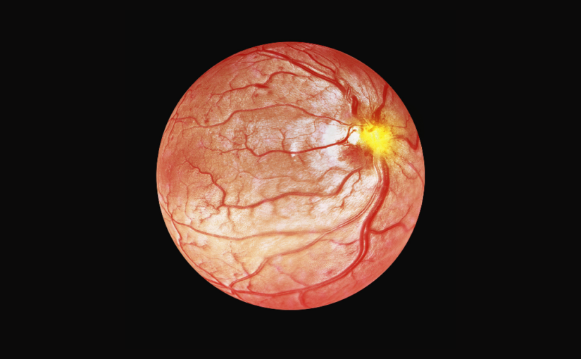 Beyond the Standard Eye Test: OCT Scan